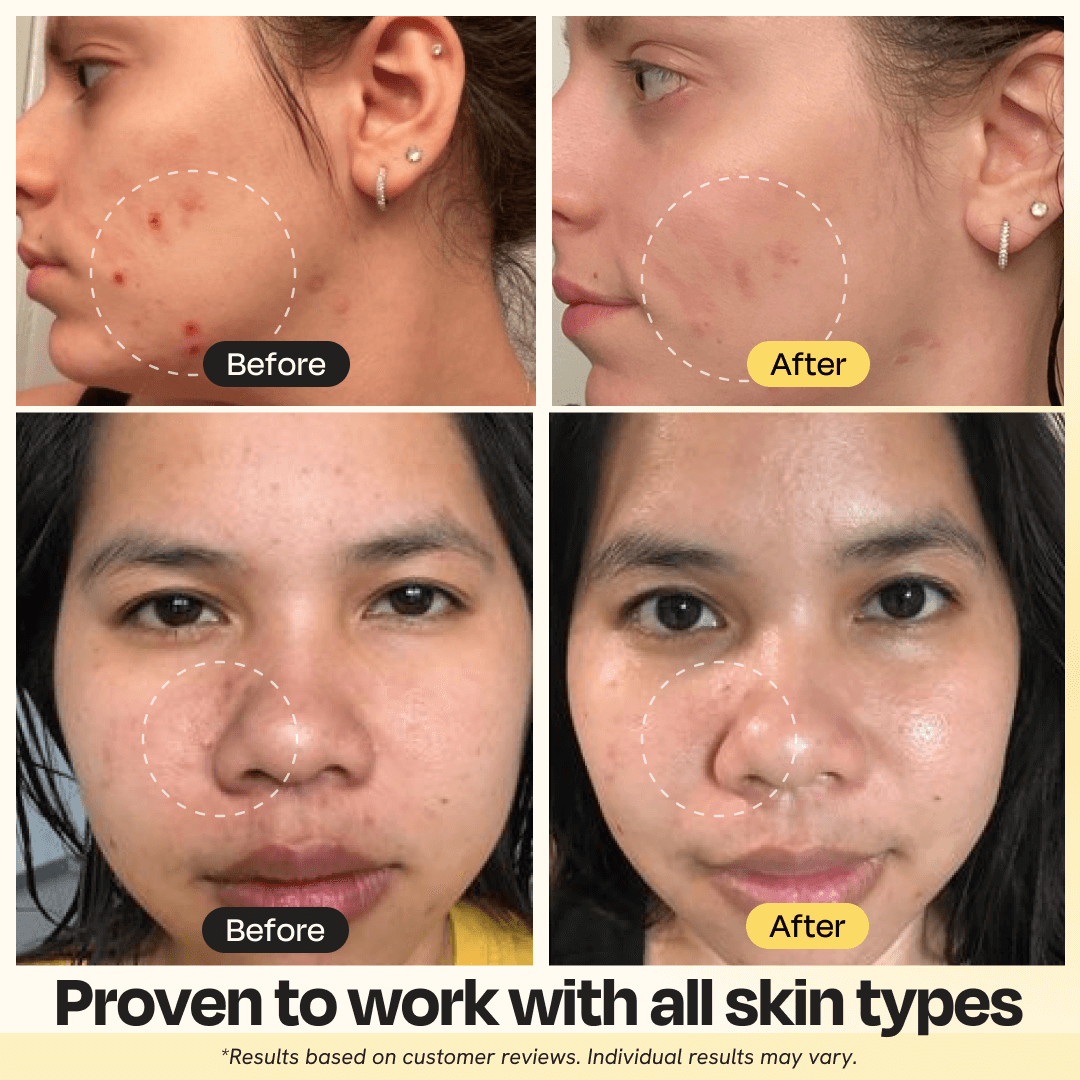 Gleamin Vitamin C Clay Mask — before-and-after results
