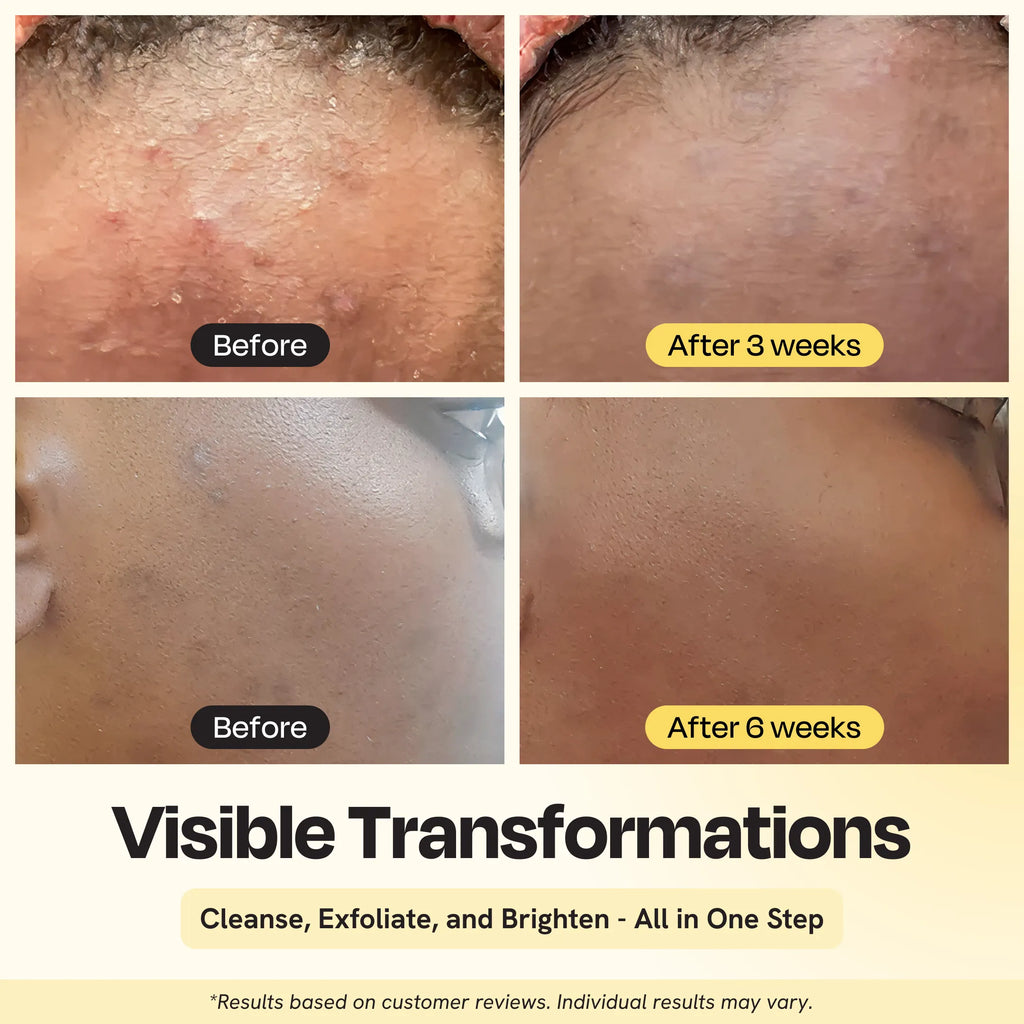 Gleamin Clarifying Brightening Cleanser — morning skincare routine