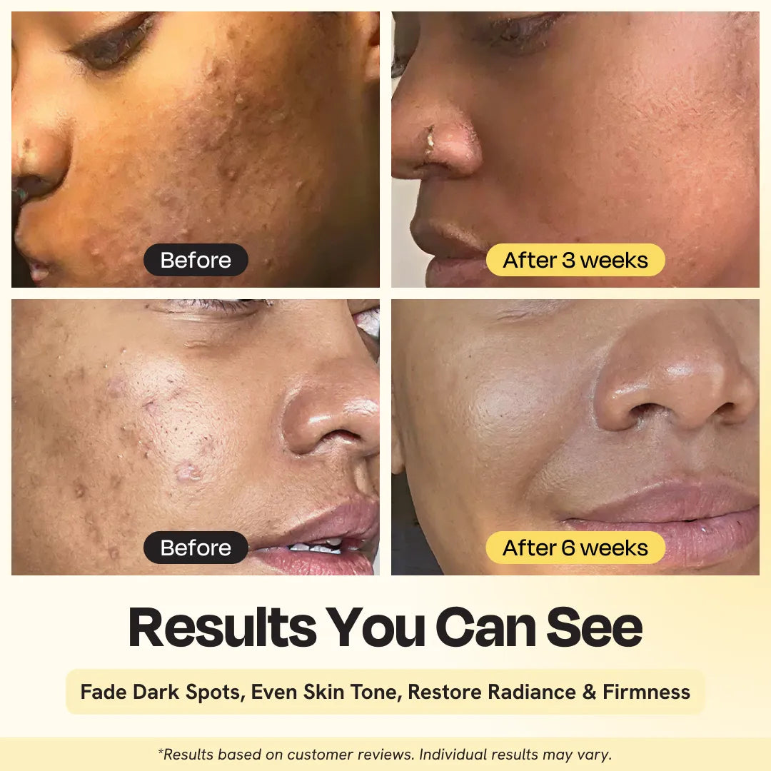 Gleamin Superactive Serum — before-and-after glow